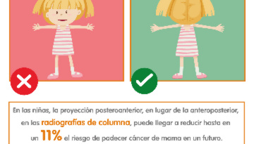 Dale la vuelta: un simple gesto para reducir el cáncer de mama