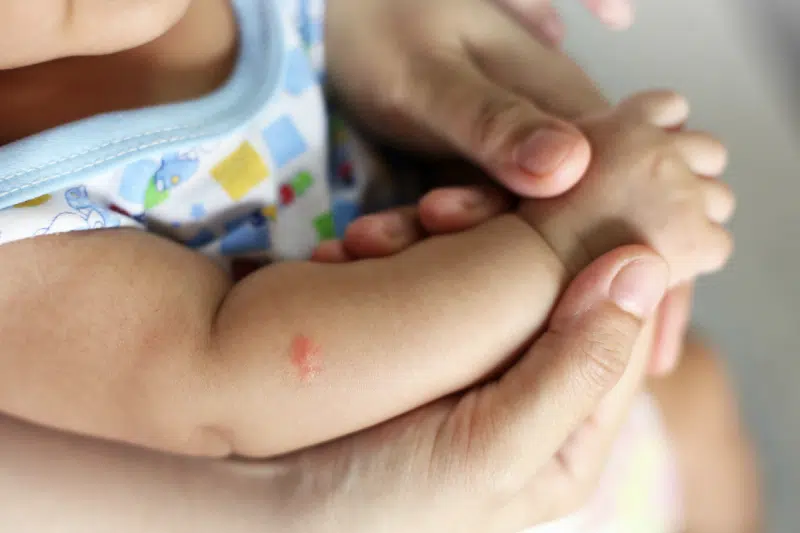 Dermatolog pediatrico en sevilla.Ihp Pediatria